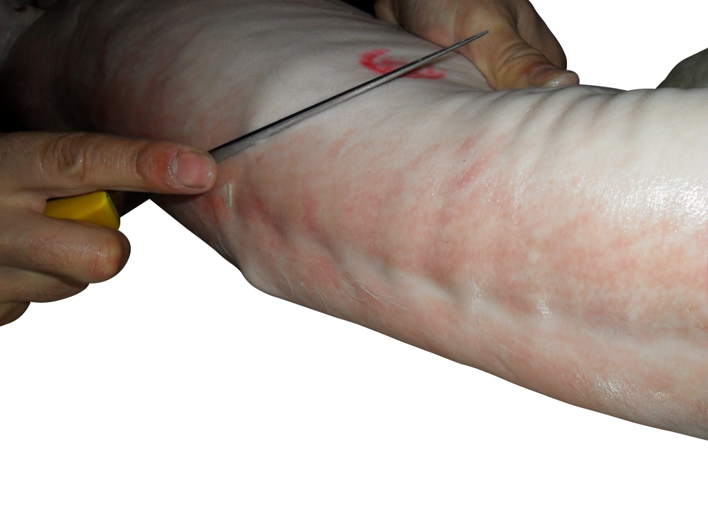 In this image you can see the pig skin being pierced with a knife for the back brace to pass through